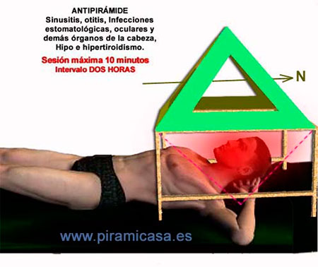 Tratamiento antipiramidal cabeza