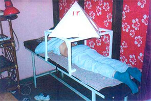 Tratamiento con pirámide en la espalada de un niño